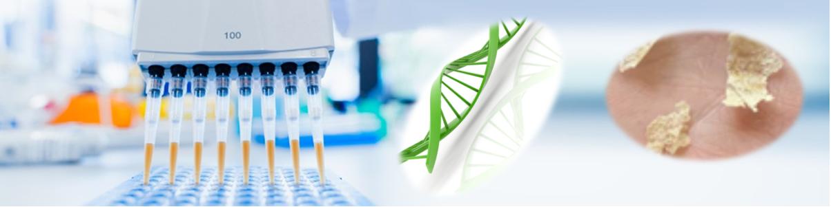 一步法頭皮屑細(xì)胞DNA純化試劑盒 一步法頭皮屑細(xì)胞DNA純化試劑盒